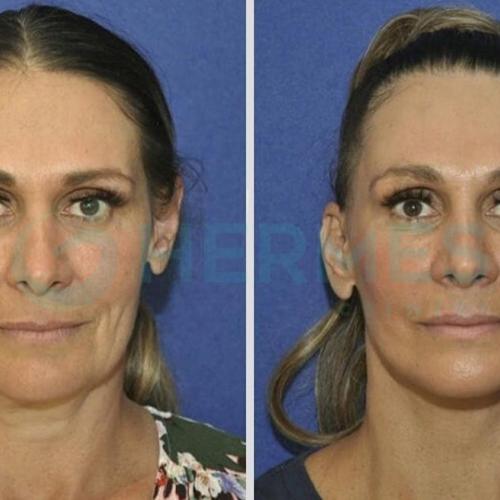 Before after photos of our patients 0